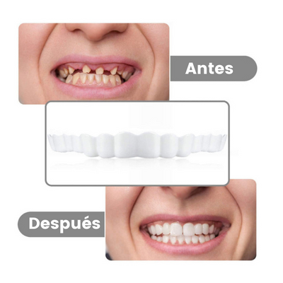 Dentadura Postiza Dientes Perfectos™