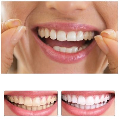 Dentadura Postiza Dientes Perfectos™